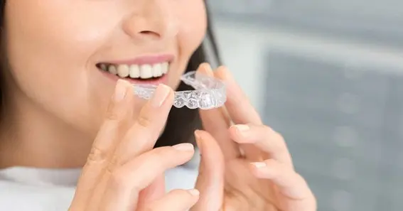 Unlocking the Magic: Your Guide to Invisalign Insertion and Removal in Las Vegas